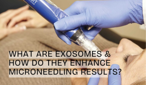 microneedling-with-exosomes