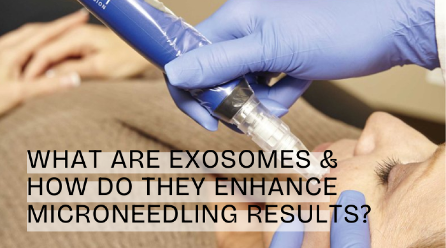 microneedling-with-exosomes